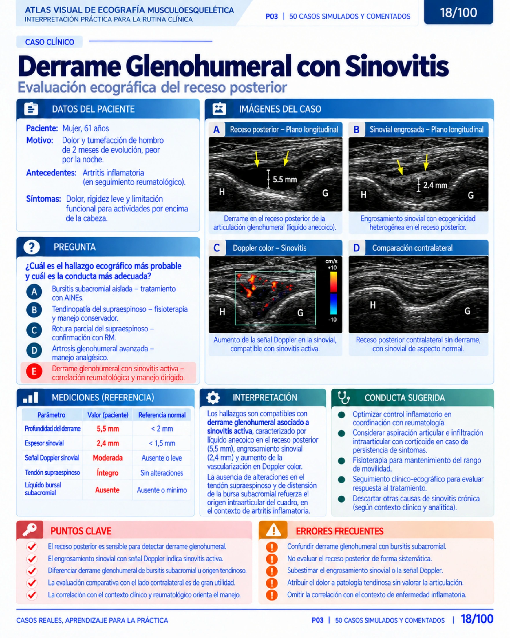 Página 18: Caso: derrame glenohumeral. Muestra del material educativo de ecografía musculoesquelética.